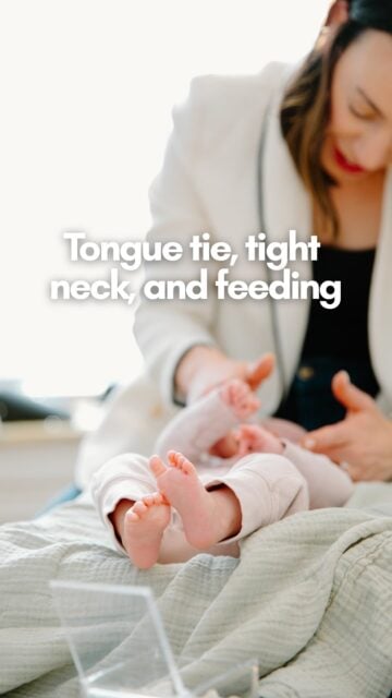 A baby does not feed with their mouth alone. They need to comfortably turn their head, open their jaw, coordinate sucking and swallowing, and create enough stability through the neck and body to maintain a latch.

When a misalignment (subluxation) is creating tension through the neck, jaw, shoulders, or cranial structures, feeding can become exhausting. You may notice a shallow latch, clicking, leaking milk, preferring one side, pulling away, or falling asleep before getting a full feed.

Releasing a tongue or lip tie changes the oral restriction, but it does not automatically unwind the tension patterns the baby developed around it. This is why chiropractic care and lactation support work so well together. One supports oral function and feeding strategy. The other addresses misalignment and nervous system interference throughout the body.

If feeding still feels harder than it should, even after you have checked the latch, contact our office to see how we can support. 

📍 Rooted Chiropractic | Serving Clarendon Hills, Hinsdale & Western Suburbs
#TongueTieSupport #InfantFeeding #PediatricChiropractic #NewbornCare #ClarendonHillsMoms RootedChiropractic